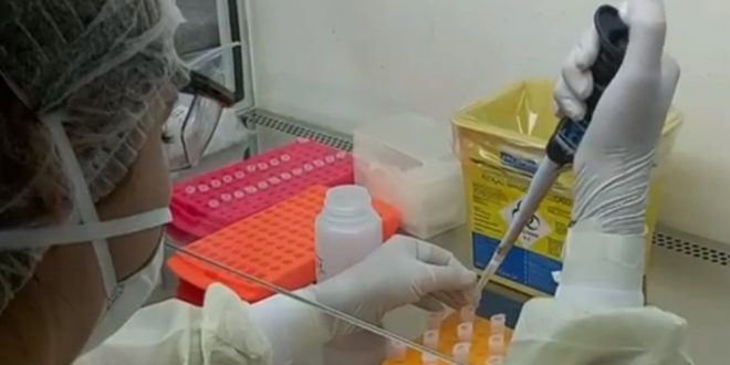 Goiás registra 49 casos confirmados e uma morte por coronavírus