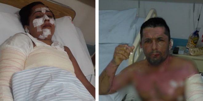 Irmãos morrem após churrasqueira acendida com álcool explodir, em Aparecida de Goiânia