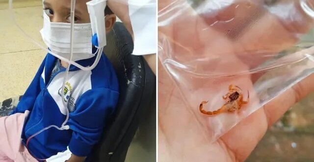 Criança é picada por escorpião enquanto estava sentada no sofá de casa, em Goiânia