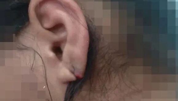 Homem é preso em Jaraguá após descumprir medida e morder a orelha da ex-mulher