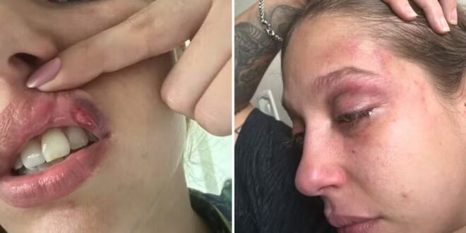 Jovem denuncia ter sido espancada com série de socos por empresário em Goiânia