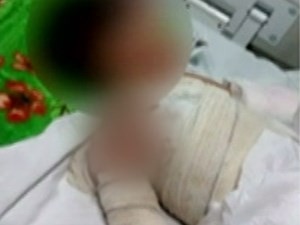 Morre bebê queimado com água quente de churrasqueira elétrica