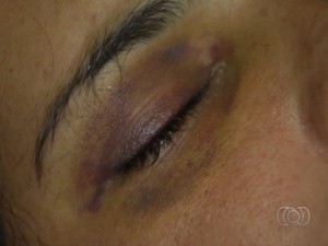 Quase 7 mil crimes contra mulheres são registrados em 1 ano, em Goiânia