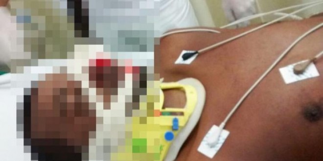 Briga entre irmãos em Uruaçu, faca fica cravada no olho da vítima