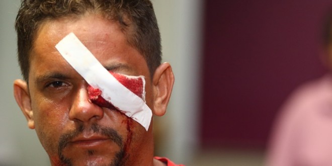 Homem de Goianésia e ferido durante protesto em Brasilia