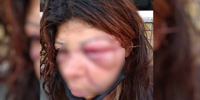 Sogra denuncia que foi espancada pelo genro ao tentar defender filha durante briga, em Goiânia