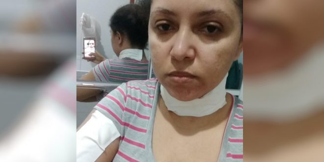 Motociclista tem o pescoço cortado por fio de energia solto em rua de Palmeiras de Goiás: ‘Eu poderia ter morrido’