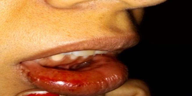 Vizinhos ouvem agressão e salvam mulher que era agredida pelo ex-companheiro em Valparaíso de Goiás, diz polícia