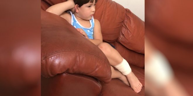 Menino de 3 anos é mordido por macaco enquanto brincava no Parque Areião em Goiânia, diz pai