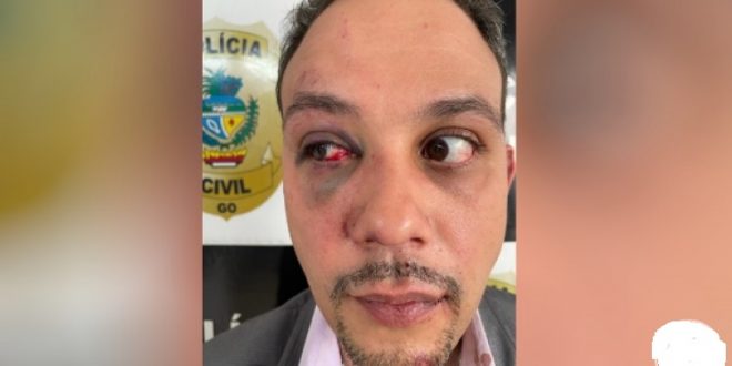 Justiça manda prender tenente filmado ao agredir advogado em calçada de Goiânia