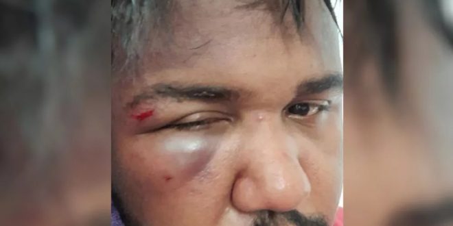 Funcionário denuncia que foi agredido por dois jovens em supermercado de Inhumas: ‘Estou muito abalado’
