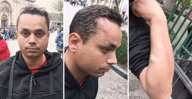 Brasileiro é espancado no Chile durante o primeiro dia de trabalho em restaurante, denuncia amigo