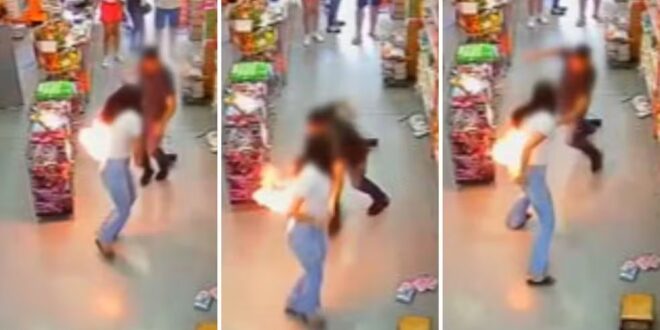 Marido de jovem que ficou ferida após celular pegar fogo no bolso da calça disse que ainda não terminou de pagar aparelho: ‘Era novo’