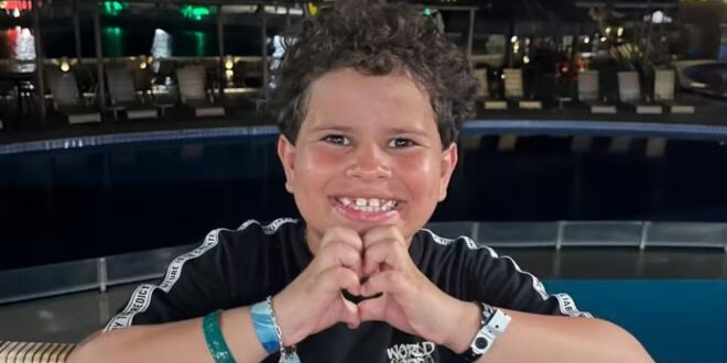 Filho de prefeito tem o rosto desfigurado após ser mordido por cachorro