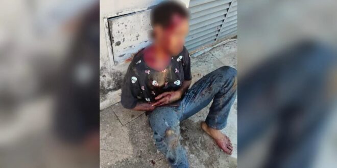 Vítima de roubo é resgatado em Anápolis com diversas perfurações de arma branca