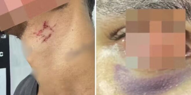Jovem é achado desnutrido e ferido após mais de um ano em cárcere para ser estuprado por traficante internacional, diz polícia