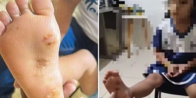 Agressões de menina de 4 anos torturada com isqueiro foram denunciadas pela escola, diz delegado