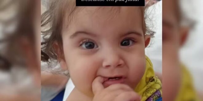 Siamesa de SP que foi separada em Goiânia morre na véspera de Natal