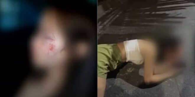 Mulher é agredida na saída de boate, em Goiânia
