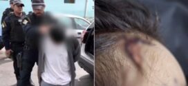 Criança morre após ser levada a unidade de saúde com sinais de espancamento em Aparecida de Goiânia