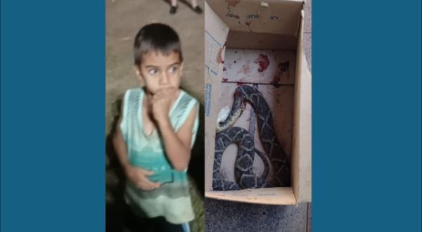 Criança de 5 anos é picada por jaracuçu na zona rural de Santa Isabel, estado de saúde é delicado