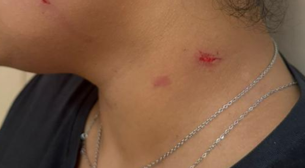 Homem é detido após denúncia de violência doméstica em ItapacI