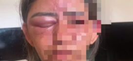 Mulher é estrangulada e espancada até desmaiar por amigo do filho em Goiás, diz polícia