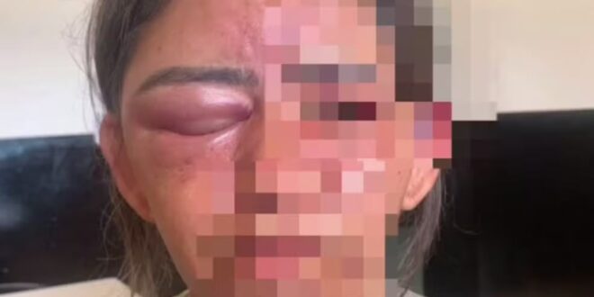 Mulher é estrangulada e espancada até desmaiar por amigo do filho em Goiás, diz polícia