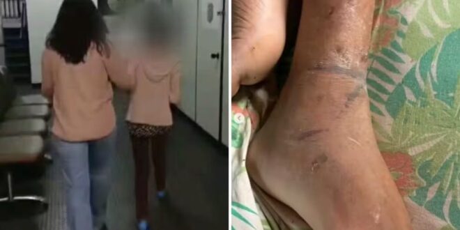 Filho acorrentado pela mãe ficava dias sem comer, sem beber água e vivia situações de extremo sofrimento, diz delegada
