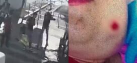 Jovem autista é baleada no rosto após sorrir para homem enquanto trabalhava na barraca da família em Goiânia