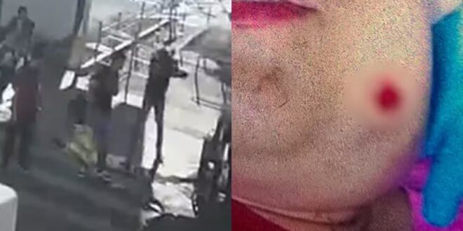 Jovem autista é baleada no rosto após sorrir para homem enquanto trabalhava na barraca da família em Goiânia