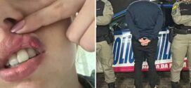 Empresário suspeito de espancar jovem é preso em Goiânia, diz polícia